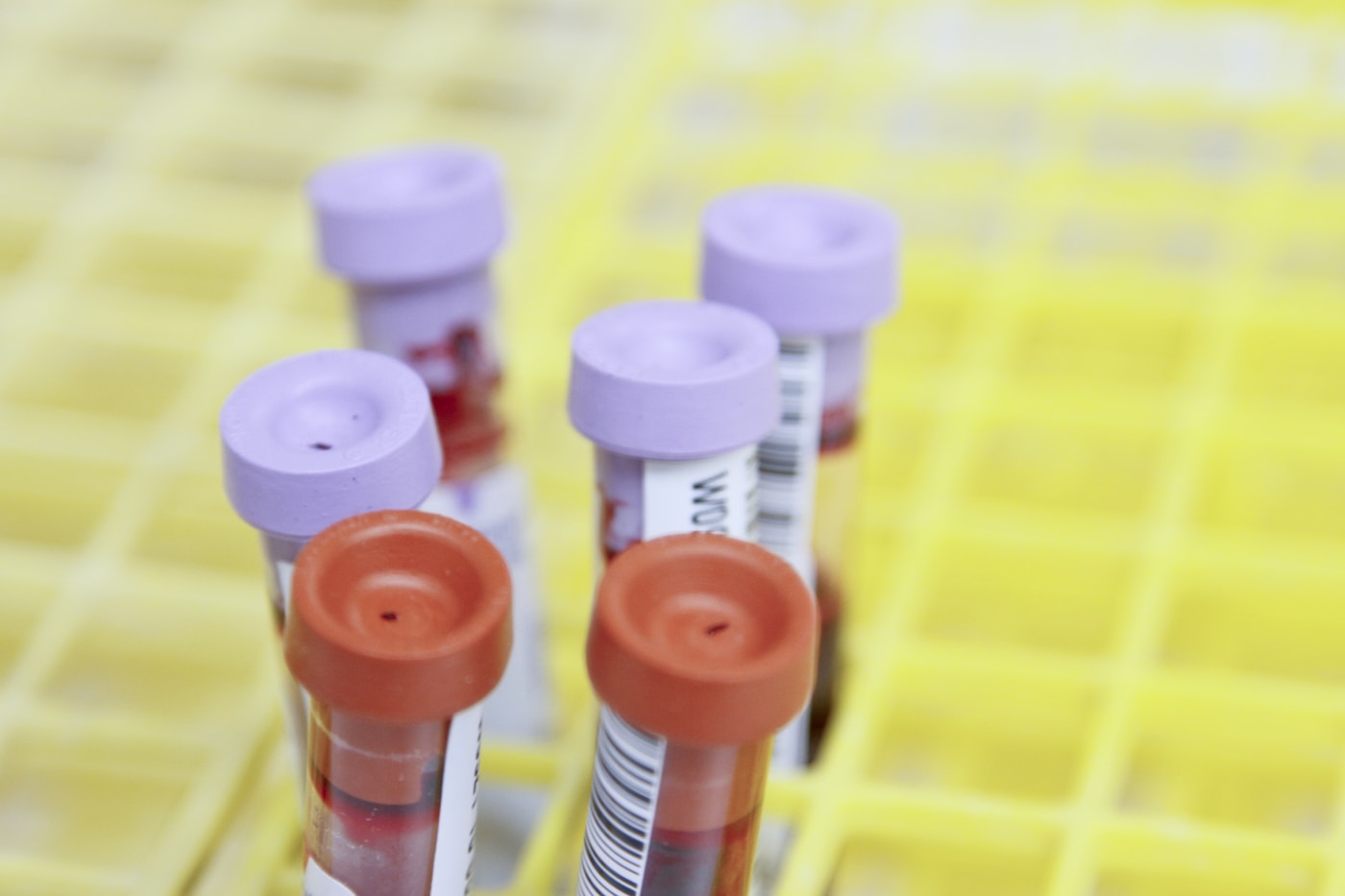 Medical lab samples for executive health checkup screening